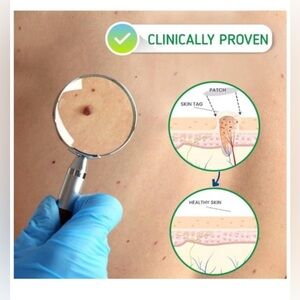 Levedi Skin Tag & Acne Remover Patch 108 patches New In Box